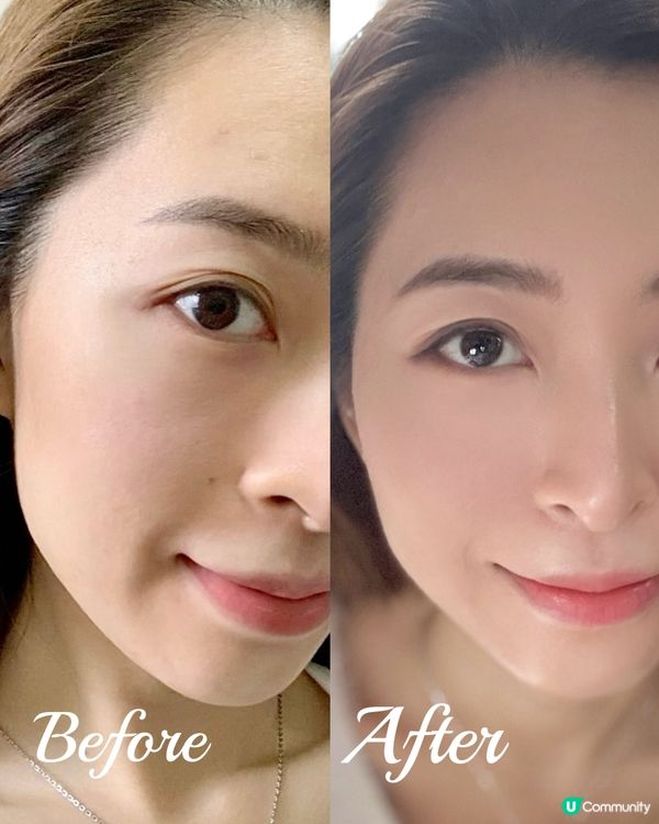 ♦️超驚艷 護膚品都可有醫美級效果♦️