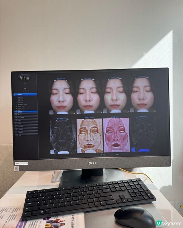 隱藏版「面部健身」全記錄 從肌肉萎縮到蘋果肌復活