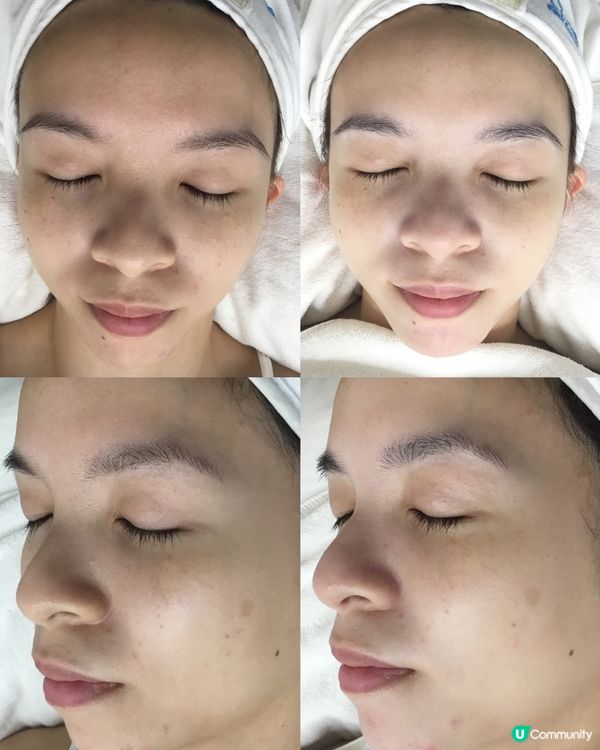 【Sk-in Studio｜AI智能清潔 & 天使光】