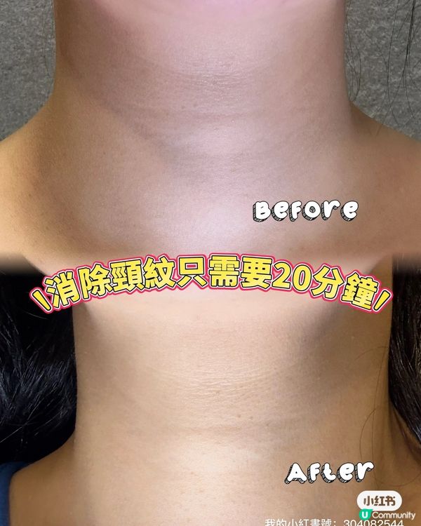 🤫🤫🤫 頸紋出賣年齡？🤫🤫🤫