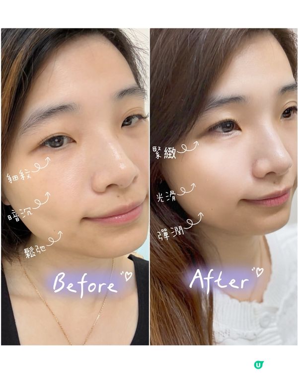 N organic『敏感肌x毛孔護理』護膚套裝