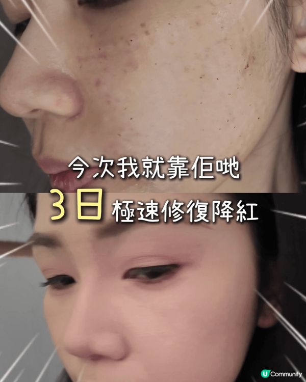 ✨【日本頂尖醫美級品牌】HAS exo幹細胞活膚系列—抗老界...