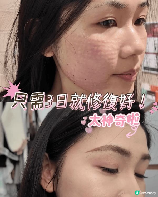 ✨【日本頂尖醫美級品牌】HAS exo幹細胞活膚系列—抗老界...