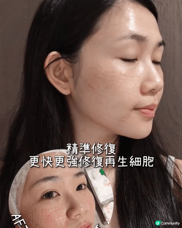 ✨【日本頂尖醫美級品牌】HAS exo幹細胞活膚系列—抗老界...