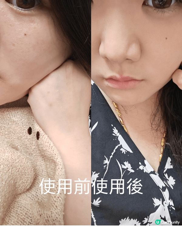 這款來自瑞士的外泌體，在一般美容院完成療程需要幾乎二千元一次...