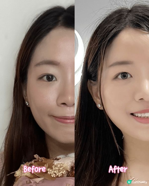 明星面膜🌟 外泌體膠原修復 🆙