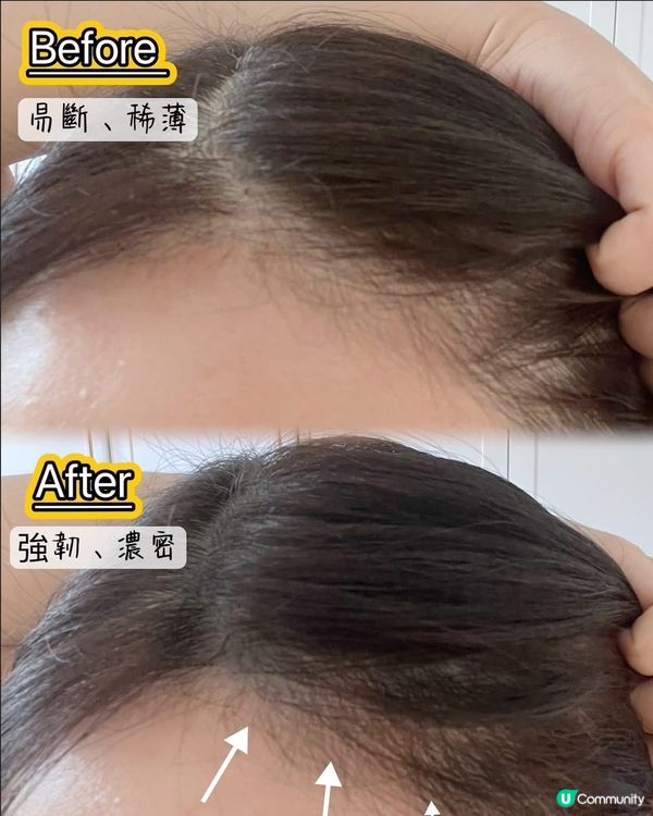 告別甩頭髮👋🏻  14日見效💪🏻