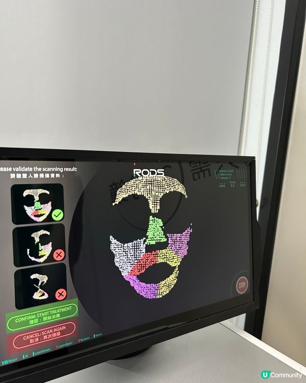 革命性美容體驗！🤩朋友做完激光嫩膚即刻見效！✨