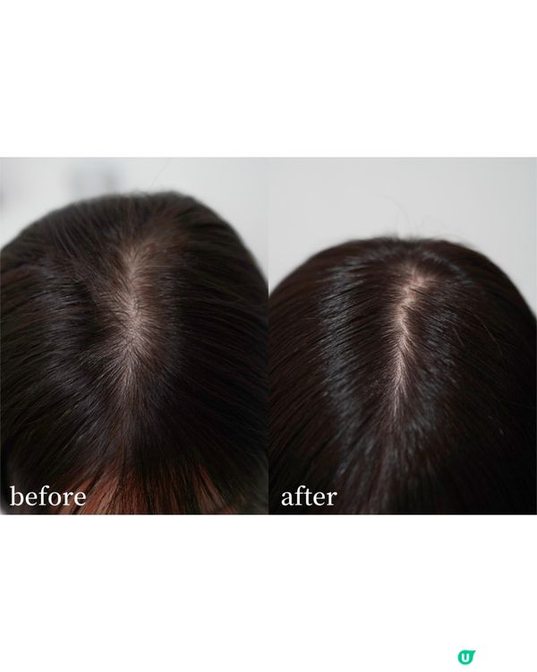 超微粉活髮新技術 配合長白山人參14日就見效?!