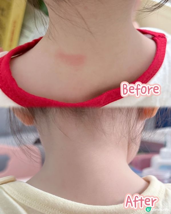 👶🏻BB皮膚過敏腸胃唔舒服？試吓用佢啦