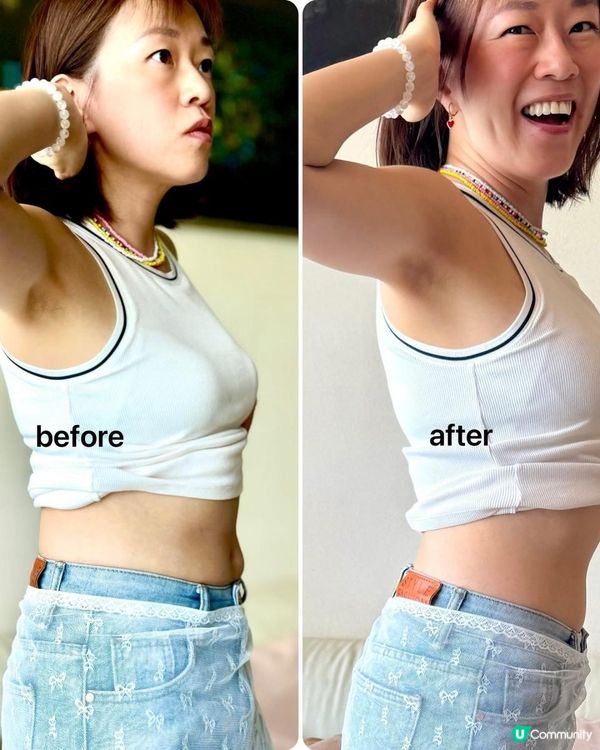 邊隻益生菌 堅 瘦到腰👇🏻👇🏻