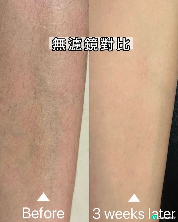 六月加開團購活動❤️‍🔥 Air10 除毛儀激安大優惠