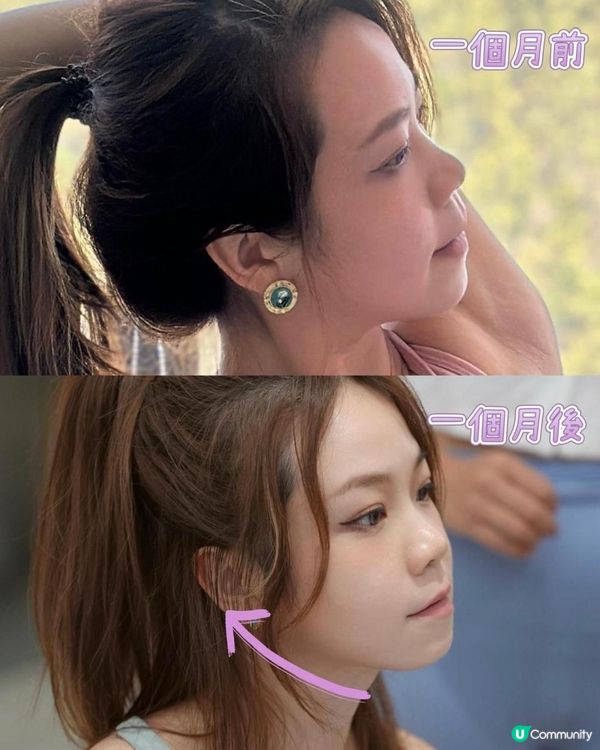 瑜珈導師都做面部普拉提！Jovena FaceStim®️深層面肌運動療程 