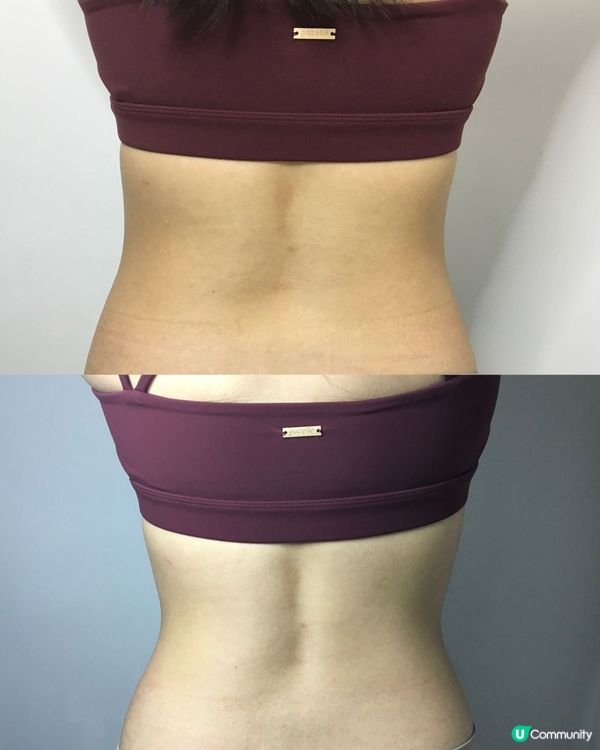 一次就有效嘅療程療🤩完全冇hard Sell