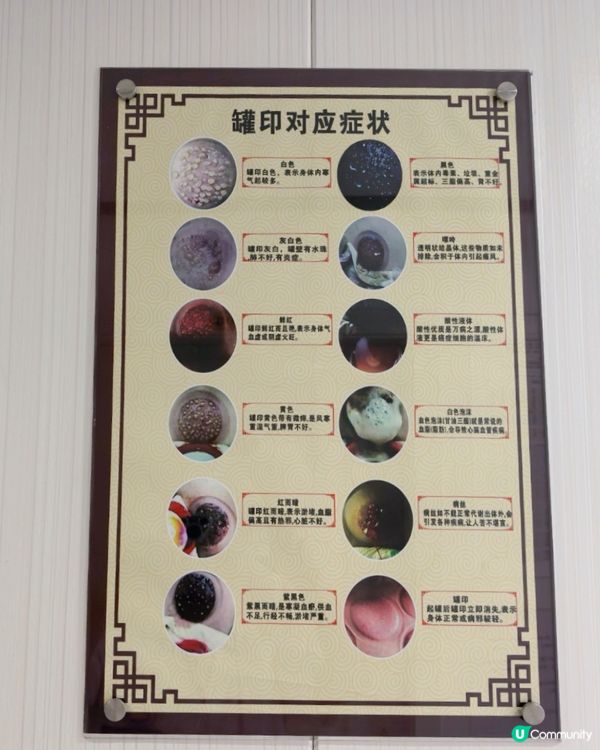 深圳易針堂中醫診所 