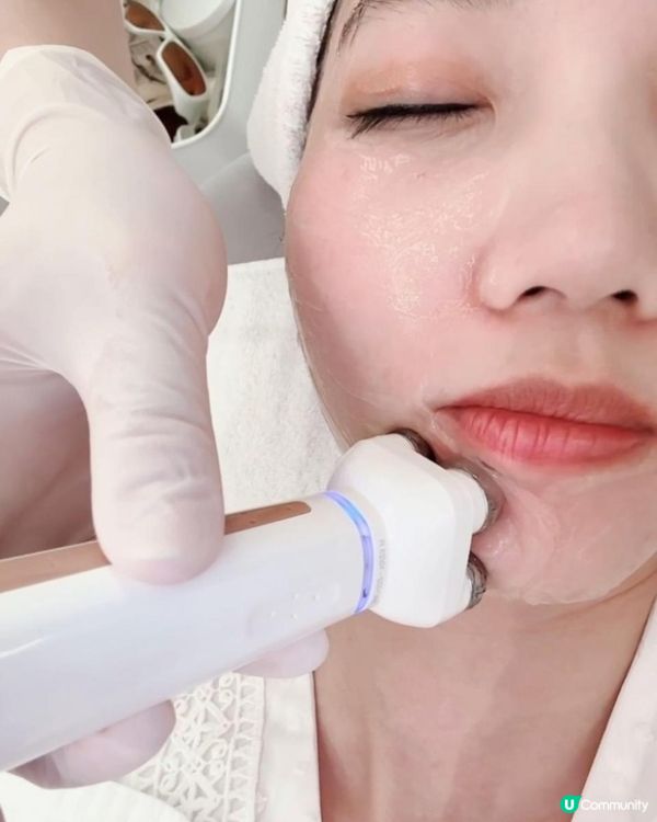 幫皮膚做Pilates！初試Jovena FaceStim®️深層面肌運動療程，效果大癲