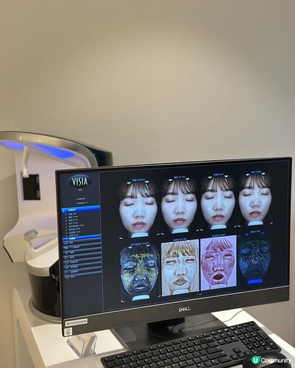 幫皮膚做Pilates！初試Jovena FaceStim®️深層面肌運動療程，效果大癲