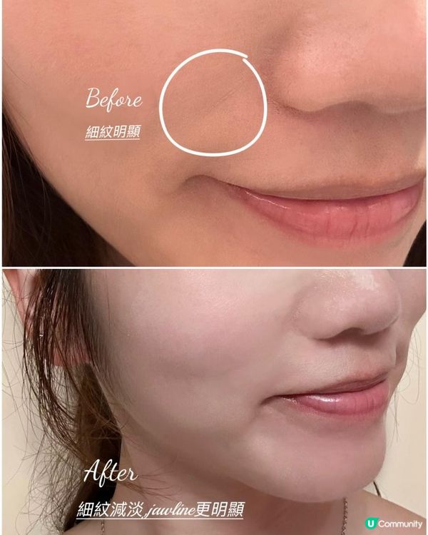 幫皮膚做Pilates！初試Jovena FaceStim®️深層面肌運動療程，效果大癲