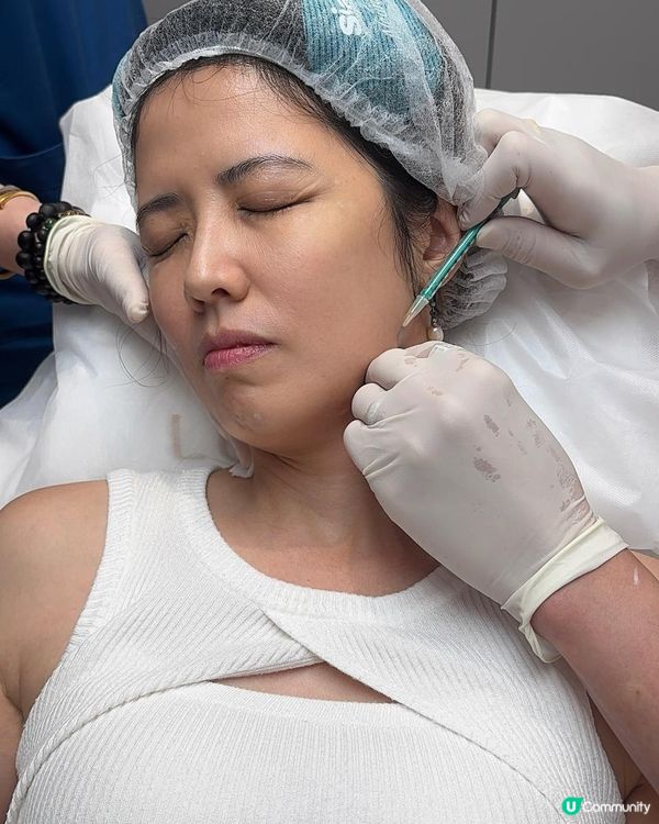 韓國Siax肉毒實測，10分鐘擺脫皺紋+下顎線鈍重