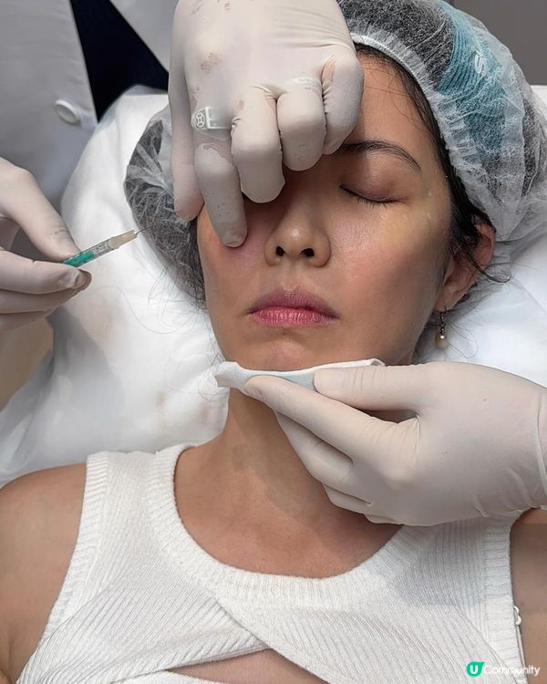 韓國Siax肉毒實測，10分鐘擺脫皺紋+下顎線鈍重