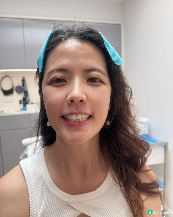 韓國Siax肉毒實測，10分鐘擺脫皺紋+下顎線鈍重