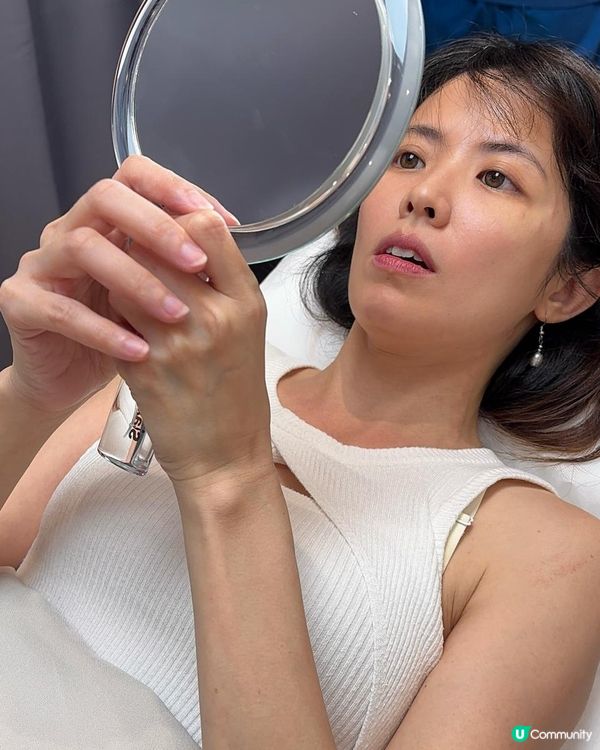 韓國Siax肉毒實測，10分鐘擺脫皺紋+下顎線鈍重