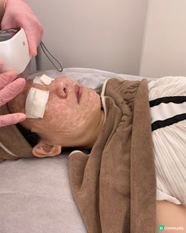 一次變白真係得？ Ku Skin BBI嫩白療程好唔好！？