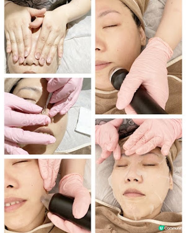 一次變白真係得？ Ku Skin BBI嫩白療程好唔好！？