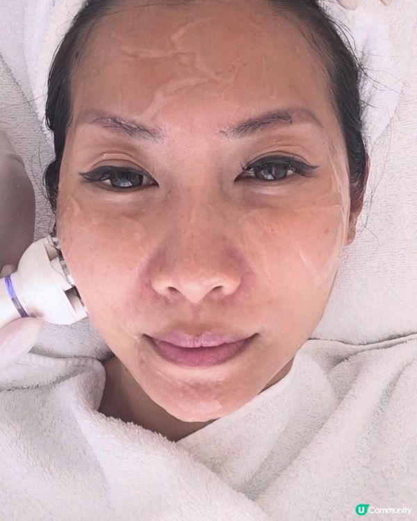 真實體驗分享｜Jovena FaceStim 面肌運動療程改善鬆弛實測