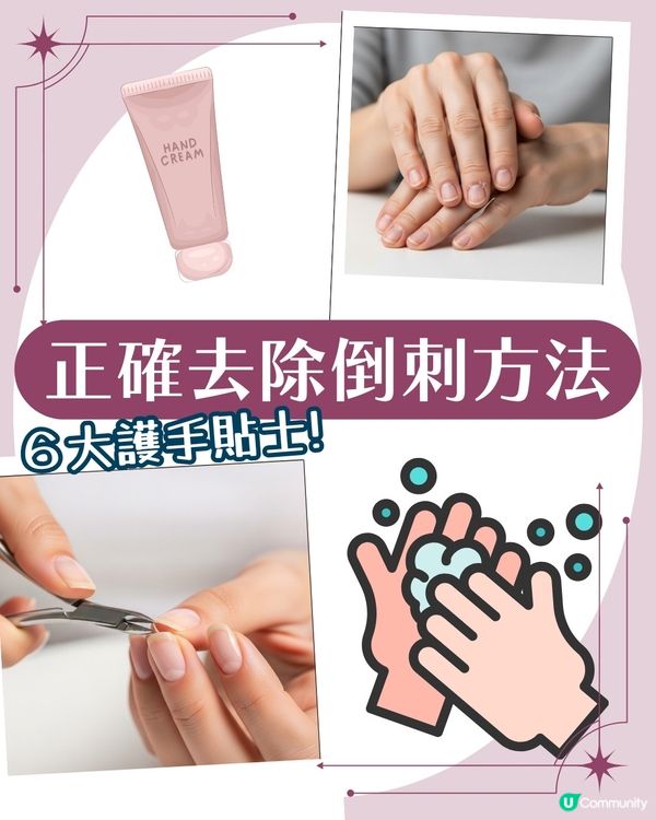 強行撕倒刺或致發炎‼ 正確去倒刺步驟+ 6大護手貼士