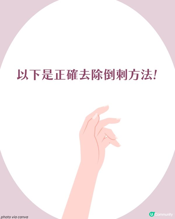 強行撕倒刺或致發炎‼ 正確去倒刺步驟+ 6大護手貼士