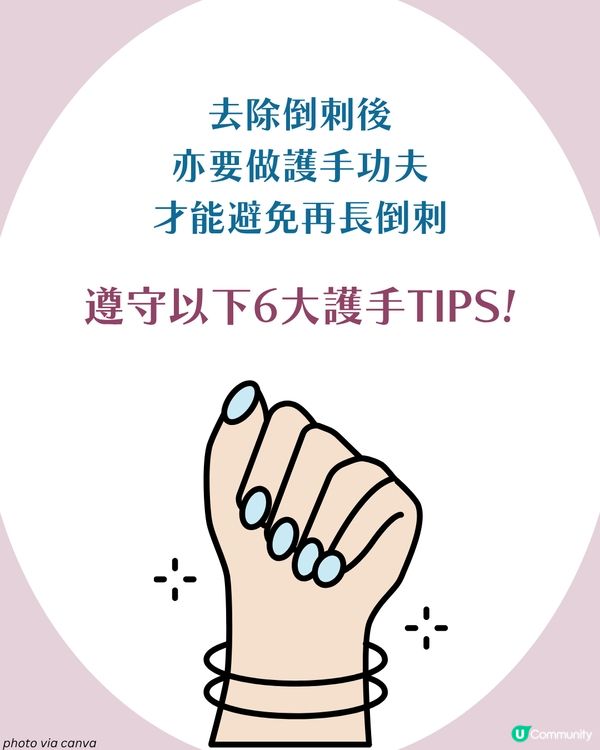 強行撕倒刺或致發炎‼ 正確去倒刺步驟+ 6大護手貼士