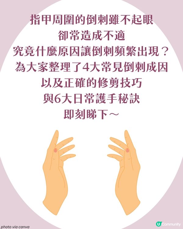 強行撕倒刺或致發炎‼ 正確去倒刺步驟+ 6大護手貼士