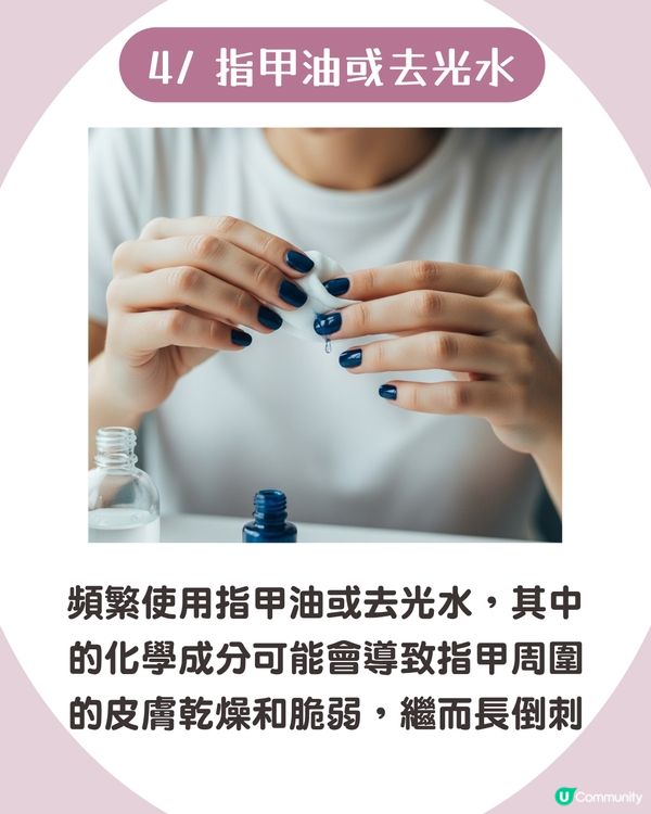 強行撕倒刺或致發炎‼ 正確去倒刺步驟+ 6大護手貼士