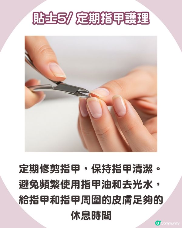 強行撕倒刺或致發炎‼ 正確去倒刺步驟+ 6大護手貼士