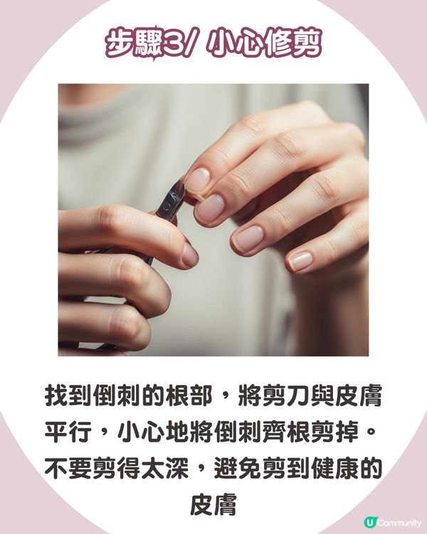 強行撕倒刺或致發炎‼ 正確去倒刺步驟+ 6大護手貼士