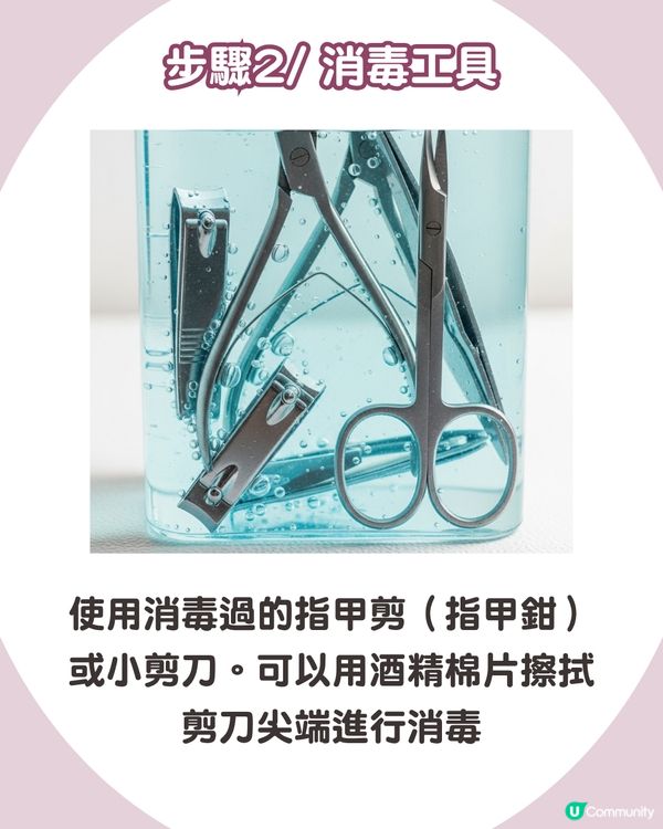 強行撕倒刺或致發炎‼ 正確去倒刺步驟+ 6大護手貼士