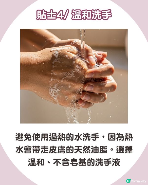 強行撕倒刺或致發炎‼ 正確去倒刺步驟+ 6大護手貼士