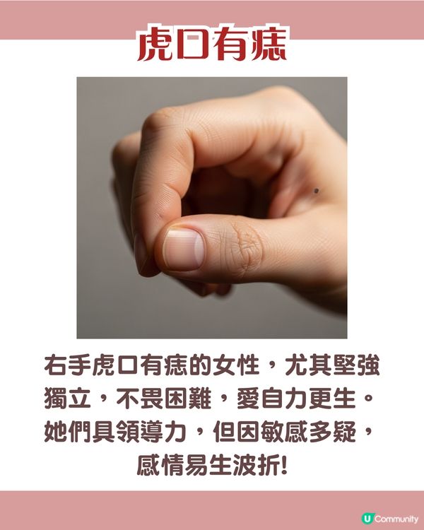 手背有痣 = 一生波折少！一篇看清手掌、手指、手背有痣的秘密