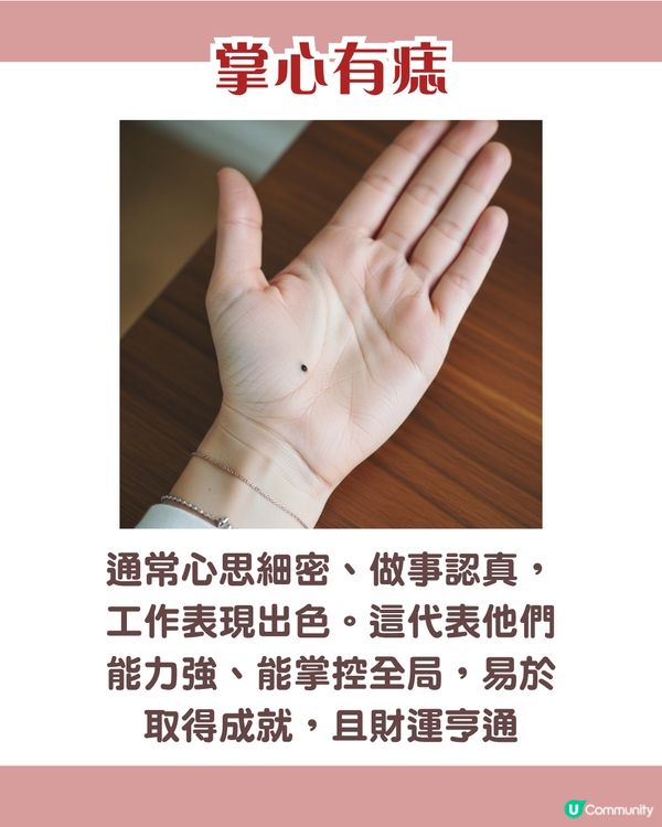 手背有痣 = 一生波折少！一篇看清手掌、手指、手背有痣的秘密