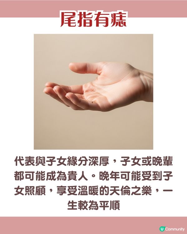 手背有痣 = 一生波折少！一篇看清手掌、手指、手背有痣的秘密