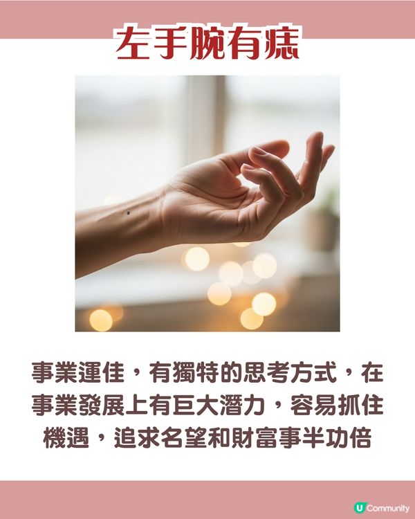 手背有痣 = 一生波折少！一篇看清手掌、手指、手背有痣的秘密