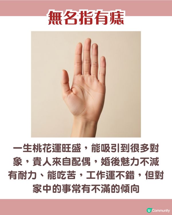 手背有痣 = 一生波折少！一篇看清手掌、手指、手背有痣的秘密