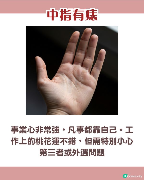 手背有痣 = 一生波折少！一篇看清手掌、手指、手背有痣的秘密