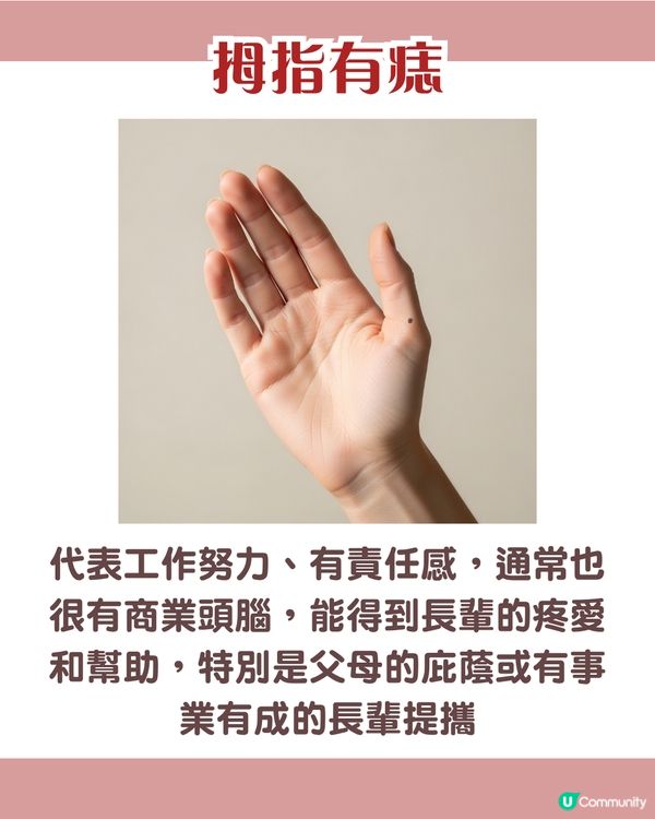 手背有痣 = 一生波折少！一篇看清手掌、手指、手背有痣的秘密