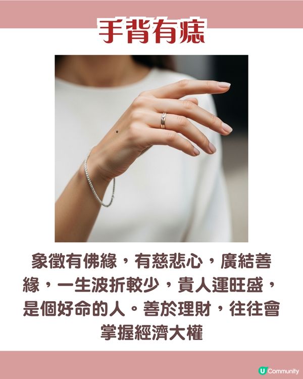 手背有痣 = 一生波折少！一篇看清手掌、手指、手背有痣的秘密