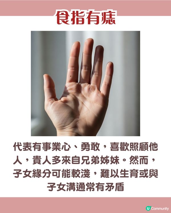 手背有痣 = 一生波折少！一篇看清手掌、手指、手背有痣的秘密