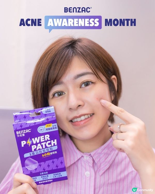 𝐁𝐞𝐧𝐳𝐚𝐜💜｜6小時去痘法👧🏻 