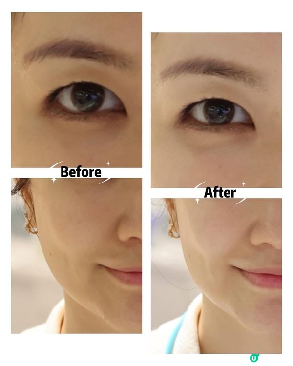 👀 15分鐘急救眼周！✨