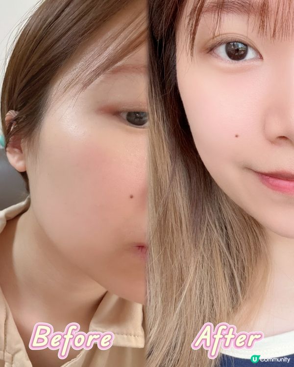 濕疹修護霜加埋益生菌，究竟效果係點？😳